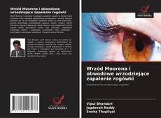 Buchcover von Wrzód Moorena i obwodowe wrzodziejące zapalenie rogówki