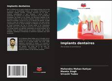 Capa do livro de Implants dentaires 