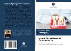 Capa do livro de Implantatgetragene Overdenture 