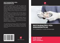 Couverture de RESTAURAÇÕES PÓS-ENDODÔNTICAS