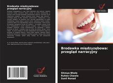 Couverture de Brodawka międzyzębowa: przegląd narracyjny