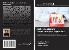 Copertina di Sobredentadura soportada por implantes