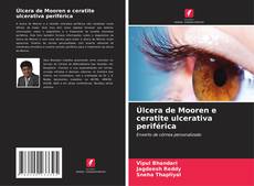 Couverture de Úlcera de Mooren e ceratite ulcerativa periférica