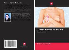 Copertina di Tumor filoide da mama