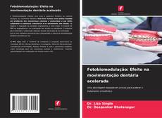 Copertina di Fotobiomodulação: Efeito na movimentação dentária acelerada