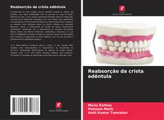 Buchcover von Reabsorção da crista edêntula