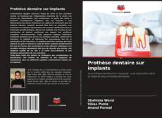Couverture de Prothèse dentaire sur implants
