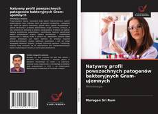 Natywny profil powszechnych patogenów bakteryjnych Gram-ujemnych kitap kapağı
