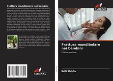 Couverture de Frattura mandibolare nei bambini