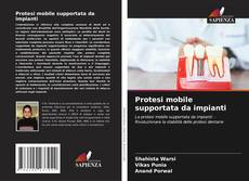 Copertina di Protesi mobile supportata da impianti