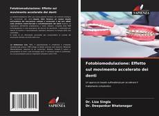 Borítókép a  Fotobiomodulazione: Effetto sul movimento accelerato dei denti - hoz
