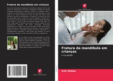 Capa do livro de Fratura da mandíbula em crianças 