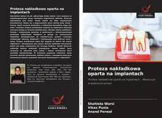 Proteza nakładkowa oparta na implantach的封面