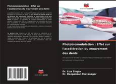 Capa do livro de Photobiomodulation : Effet sur l'accélération du mouvement des dents 