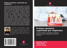 Couverture de Prótese dentária suportada por implantes