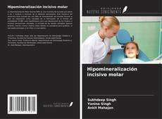 Portada del libro de Hipomineralización incisivo molar