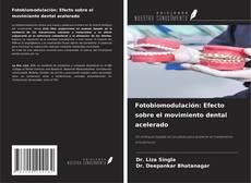 Borítókép a  Fotobiomodulación: Efecto sobre el movimiento dental acelerado - hoz
