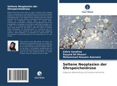 Bookcover of Seltene Neoplasien der Ohrspeicheldrüse