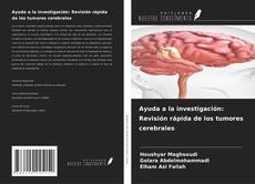 Copertina di Ayuda a la investigación: Revisión rápida de los tumores cerebrales