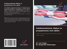 Fotobiomodulacja: Wpływ na przyspieszony ruch zębów的封面