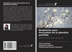 Copertina di Neoplasias poco frecuentes de la glándula parótida