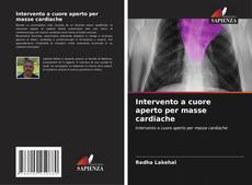 Capa do livro de Intervento a cuore aperto per masse cardiache 