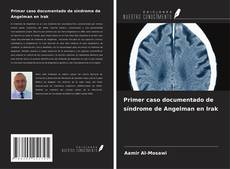 Buchcover von Primer caso documentado de síndrome de Angelman en Irak