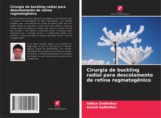 Buchcover von Cirurgia de buckling radial para descolamento de retina regmatogênico