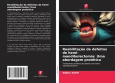 Reabilitação de defeitos de hemi-mandibulectomia: Uma abordagem protética的封面