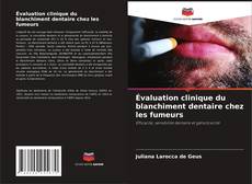 Portada del libro de Évaluation clinique du blanchiment dentaire chez les fumeurs