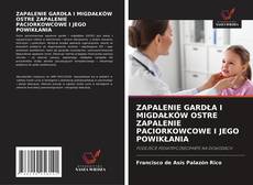 Buchcover von ZAPALENIE GARDŁA I MIGDAŁKÓW OSTRE ZAPALENIE PACIORKOWCOWE I JEGO POWIKŁANIA