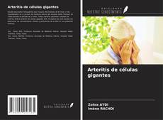 Buchcover von Arteritis de células gigantes