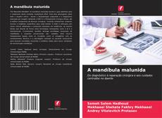 A mandíbula malunida的封面