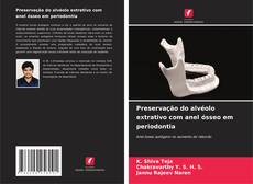 Buchcover von Preservação do alvéolo extrativo com anel ósseo em periodontia