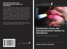 Evaluación clínica del blanqueamiento dental en fumadores的封面