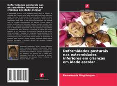 Couverture de Deformidades posturais nas extremidades inferiores em crianças em idade escolar