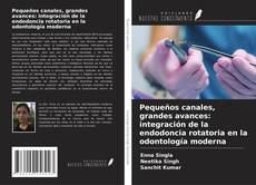 Bookcover of Pequeños canales, grandes avances: integración de la endodoncia rotatoria en la odontología moderna