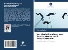 Capa do livro de Nachholbehandlung von Prostatakrebs nach Prostatektomie 