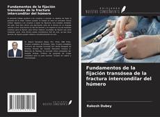 Обложка Fundamentos de la fijación transósea de la fractura intercondilar del húmero