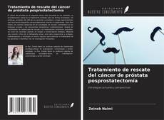 Tratamiento de rescate del cáncer de próstata posprostatectomía的封面
