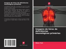 Buchcover von Imagens de tórax de deficiências imunológicas primárias