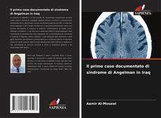Il primo caso documentato di sindrome di Angelman in Iraq的封面
