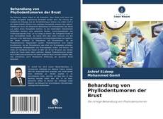 Обложка Behandlung von Phyllodentumoren der Brust