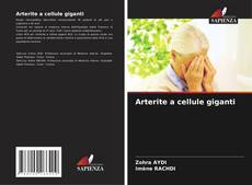 Portada del libro de Arterite a cellule giganti
