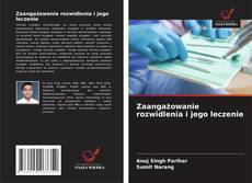 Borítókép a  Zaangażowanie rozwidlenia i jego leczenie - hoz