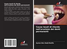 Couverture de Cause locali di ritardo nell'eruzione dei denti permanenti