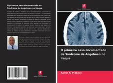Portada del libro de O primeiro caso documentado de Síndrome de Angelman no Iraque