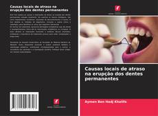 Обложка Causas locais de atraso na erupção dos dentes permanentes