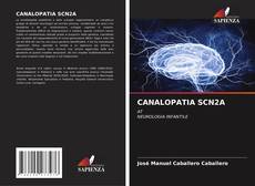 Buchcover von CANALOPATIA SCN2A