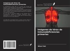 Copertina di Imágenes de tórax de inmunodeficiencias primarias